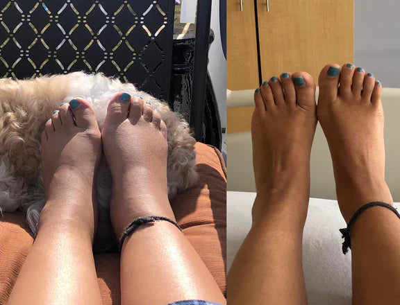 S-CALCETASCOMPRESION